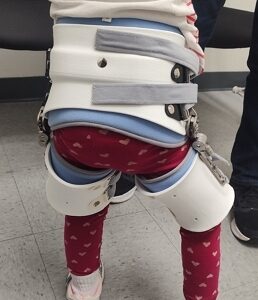 Sequoia Pediatric Hip Brace